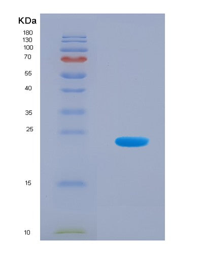 SDS-PAGE analysis of Human C5orf24 (Upf0461 Protein C5Orf24) - Recombinant Protein, CAT# BLT-08613P showing >90% purity under 15% SDS-PAGE (Reduced)