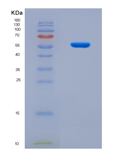 SDS-PAGE analysis of Mouse Nptx1 (Neuronal Pentraxin-1) - Recombinant Protein, CAT# BLT-08614P showing >90% purity under 15% SDS-PAGE (Reduced)