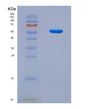 SDS-PAGE analysis of Mouse Nptx1 (Neuronal Pentraxin-1) - Recombinant Protein, CAT# BLT-08614P showing >90% purity under 15% SDS-PAGE (Reduced)