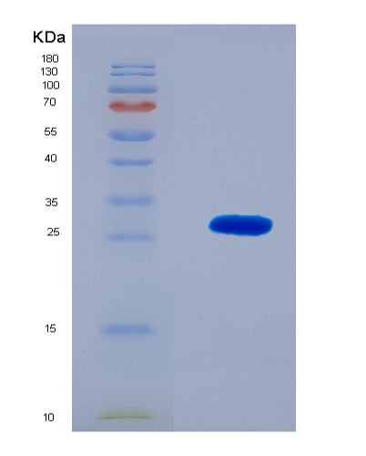 SDS-PAGE analysis of Human RSPO1 (R-Spondin-1) - Recombinant Protein, CAT# BLT-08615P showing >90% purity under 15% SDS-PAGE (Reduced)