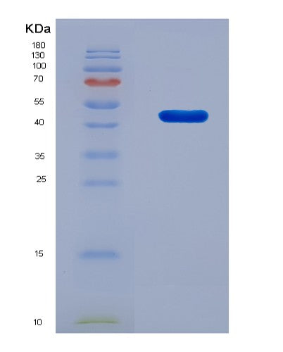 SDS-PAGE analysis of Human TARDBP (Tar Dna-Binding Protein 43) - Recombinant Protein, CAT# BLT-08616P showing >90% purity under 15% SDS-PAGE (Reduced)