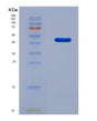 SDS-PAGE analysis of Human TARDBP (Tar Dna-Binding Protein 43) - Recombinant Protein, CAT# BLT-08616P showing >90% purity under 15% SDS-PAGE (Reduced)