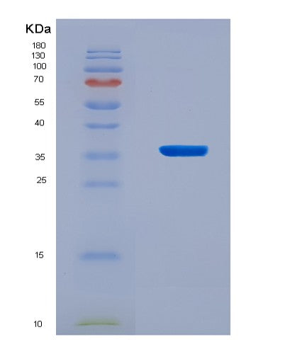 SDS-PAGE analysis of Human TARDBP (Tar Dna-Binding Protein 43) - Recombinant Protein, CAT# BLT-08617P showing >90% purity under 15% SDS-PAGE (Reduced)