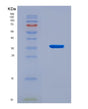 SDS-PAGE analysis of Human TARDBP (Tar Dna-Binding Protein 43) - Recombinant Protein, CAT# BLT-08617P showing >90% purity under 15% SDS-PAGE (Reduced)