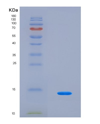 SDS-PAGE analysis of Human PLOD1 (Procollagen-Lysine,2-Oxoglutarate 5-Dioxygenase 1) - Recombinant Protein, CAT# BLT-08620P showing >90% purity under 15% SDS-PAGE (Reduced)