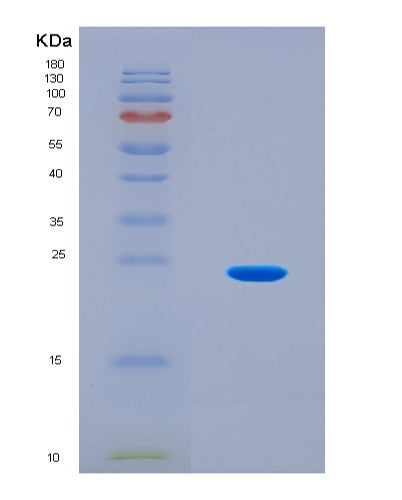 SDS-PAGE analysis of Human UBA6 (Ubiquitin-Like Modifier-Activating Enzyme 6) - Recombinant Protein, CAT# BLT-08621P showing >90% purity under 15% SDS-PAGE (Reduced)