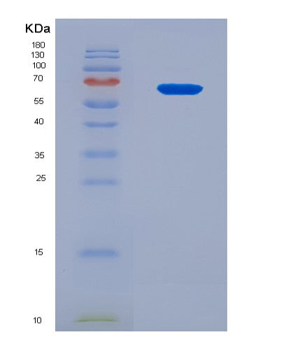 SDS-PAGE analysis of Human ALB (Albumin) - Recombinant Protein, CAT# BLT-08623P showing >90% purity under 15% SDS-PAGE (Reduced)