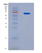 SDS-PAGE analysis of Human ALB (Albumin) - Recombinant Protein, CAT# BLT-08623P showing >90% purity under 15% SDS-PAGE (Reduced)