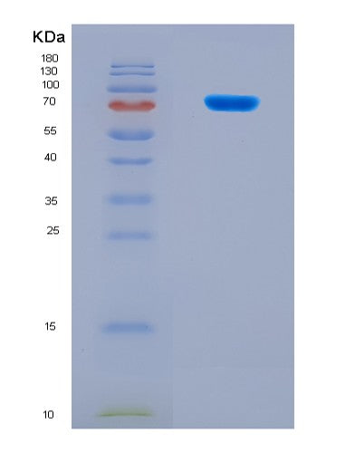 SDS-PAGE analysis of Human CUL2 (Cullin-2) - Recombinant Protein, CAT# BLT-08624P showing >90% purity under 15% SDS-PAGE (Reduced)
