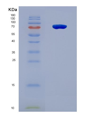 SDS-PAGE analysis of Human SPP1 (Osteopontin) - Recombinant Protein, CAT# BLT-08628P showing >90% purity under 15% SDS-PAGE (Reduced)