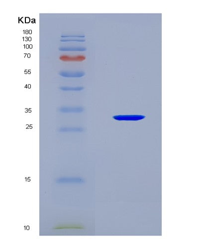 SDS-PAGE analysis of Mouse Insrr (Insulin Receptor-Related Protein) - Recombinant Protein, CAT# BLT-08629P showing >90% purity under 15% SDS-PAGE (Reduced)