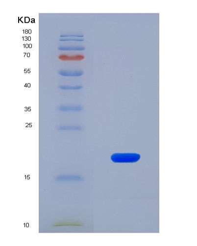 SDS-PAGE analysis of Human COL6A1 (Collagen Alpha-1(Vi) Chain) - Recombinant Protein, CAT# BLT-08632P showing >90% purity under 15% SDS-PAGE (Reduced)