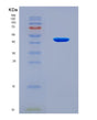 SDS-PAGE analysis of Human ZBP1 (Z-Dna-Binding Protein 1) - Recombinant Protein, CAT# BLT-08635P showing >90% purity under 15% SDS-PAGE (Reduced)