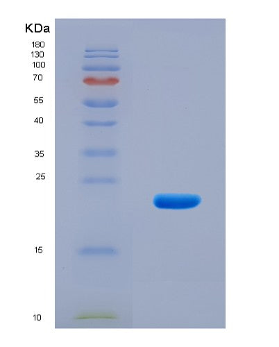 SDS-PAGE analysis of Human ACKR3 (Atypical Chemokine Receptor 3) - Recombinant Protein, CAT# BLT-08636P showing >90% purity under 15% SDS-PAGE (Reduced)