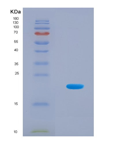 SDS-PAGE analysis of Human CXCR4 (C-X-C Chemokine Receptor Type 4) - Recombinant Protein, CAT# BLT-08637P showing >90% purity under 15% SDS-PAGE (Reduced)