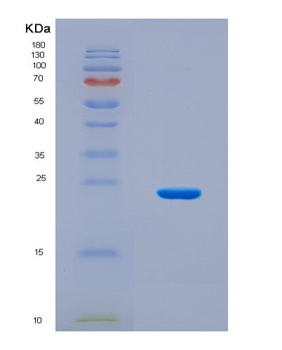 SDS-PAGE analysis of Human RNF43 (E3 Ubiquitin-Protein Ligase Rnf43) - Recombinant Protein, CAT# BLT-08638P showing >90% purity under 15% SDS-PAGE (Reduced)