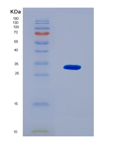 SDS-PAGE analysis of Human ZNRF3 (E3 Ubiquitin-Protein Ligase Znrf3) - Recombinant Protein, CAT# BLT-08639P showing >90% purity under 15% SDS-PAGE (Reduced)