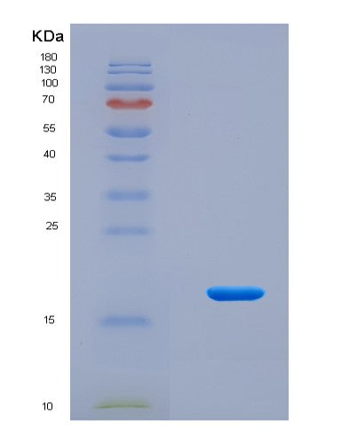 SDS-PAGE analysis of Human PLAU (Urokinase-Type Plasminogen Activator) - Recombinant Protein, CAT# BLT-08641P showing >90% purity under 15% SDS-PAGE (Reduced)