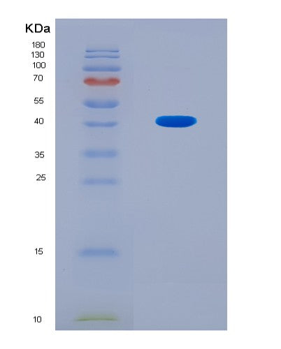 SDS-PAGE analysis of Mouse B3gnt3 (N-Acetyllactosaminide Beta-1,3-N-Acetylglucosaminyltransferase 3) - Recombinant Protein, CAT# BLT-08642P showing >90% purity under 15% SDS-PAGE (Reduced)