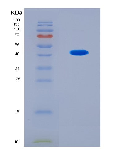 SDS-PAGE analysis of Human WFDC2 (Wap Four-Disulfide Core Domain Protein 2) - Recombinant Protein, CAT# BLT-08645P showing >90% purity under 15% SDS-PAGE (Reduced)