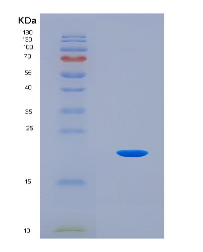 SDS-PAGE analysis of Mouse Fgf2 (Fibroblast Growth Factor 2) - Recombinant Protein, CAT# BLT-08651P showing >95% purity under 15% SDS-PAGE (Reduced)