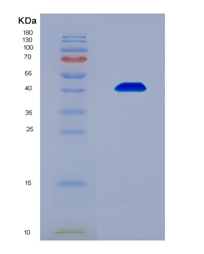 SDS-PAGE analysis of Human MDM2 (E3 Ubiquitin-Protein Ligase Mdm2) - Recombinant Protein, CAT# BLT-08653P showing >90% purity under 15% SDS-PAGE (Reduced)