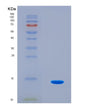 SDS-PAGE analysis of Human SNCA (Alpha-Synuclein) - Recombinant Protein, CAT# BLT-08654P showing >90% purity under 15% SDS-PAGE (Reduced)