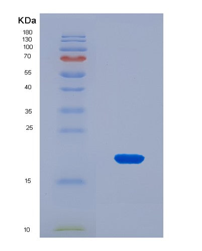 SDS-PAGE analysis of Human LRIG3 (Leucine-Rich Repeats And Immunoglobulin-Like Domains Protein 3) - Recombinant Protein, CAT# BLT-08655P showing >90% purity under 15% SDS-PAGE (Reduced)
