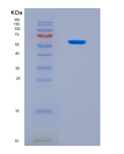 SDS-PAGE analysis of Mouse Fgl1 (Fibrinogen-Like Protein 1) - Recombinant Protein, CAT# BLT-08656P showing >90% purity under 15% SDS-PAGE (Reduced)