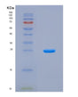 SDS-PAGE analysis of Mouse Bcl7c (B-Cell Cll/Lymphoma 7 Protein Family Member C) - Recombinant Protein, CAT# BLT-08657P showing >90% purity under 15% SDS-PAGE (Reduced)