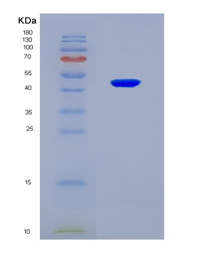 SDS-PAGE analysis of Human ALKBH5 (Rna Demethylase Alkbh5) - Recombinant Protein, CAT# BLT-08661P showing >90% purity under 15% SDS-PAGE (Reduced)
