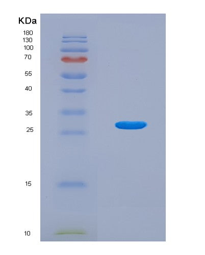 SDS-PAGE analysis of Human CAMK2G (Calcium/Calmodulin-Dependent Protein Kinase Type Ii Subunit Gamma) - Recombinant Protein, CAT# BLT-08662P showing >90% purity under 15% SDS-PAGE (Reduced)