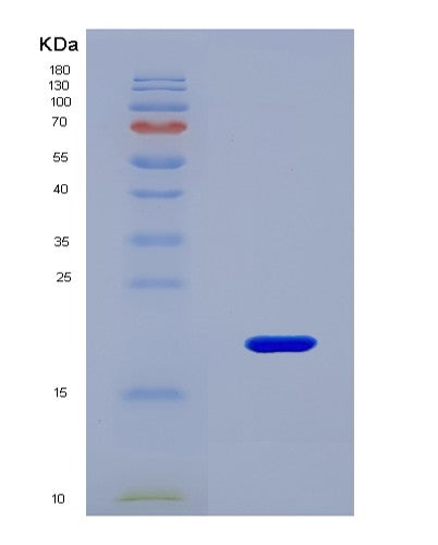 SDS-PAGE analysis of Mouse Rrn3 (Rna Polymerase I-Specific Transcription Initiation Factor Rrn3) - Recombinant Protein, CAT# BLT-08663P showing >90% purity under 15% SDS-PAGE (Reduced)