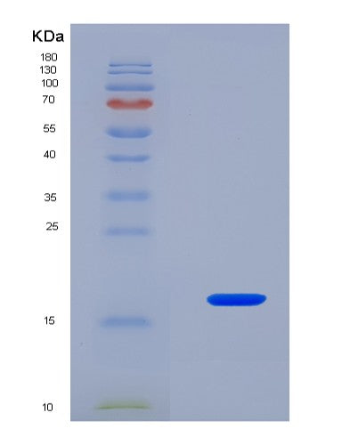 SDS-PAGE analysis of Mouse Rprd2 (Regulation Of Nuclear Pre-Mrna Domain-Containing Protein 2) - Recombinant Protein, CAT# BLT-08664P showing >90% purity under 15% SDS-PAGE (Reduced)