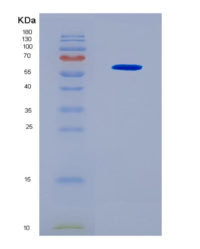 SDS-PAGE analysis of Human GBP5 (Guanylate-Binding Protein 5) - Recombinant Protein, CAT# BLT-08671P showing >90% purity under 15% SDS-PAGE (Reduced)