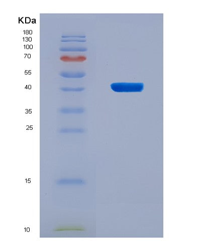 SDS-PAGE analysis of Human KL (Klotho) - Recombinant Protein, CAT# BLT-08673P showing >90% purity under 15% SDS-PAGE (Reduced)