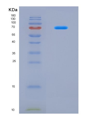 SDS-PAGE analysis of Human COP1 (E3 Ubiquitin-Protein Ligase Cop1) - Recombinant Protein, CAT# BLT-08677P showing >90% purity under 15% SDS-PAGE (Reduced)