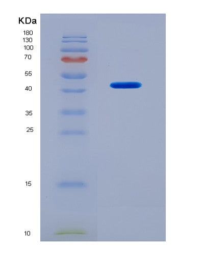 SDS-PAGE analysis of Human BMP10 (Bone Morphogenetic Protein 10) - Recombinant Protein, CAT# BLT-08679P showing >90% purity under 15% SDS-PAGE (Reduced)