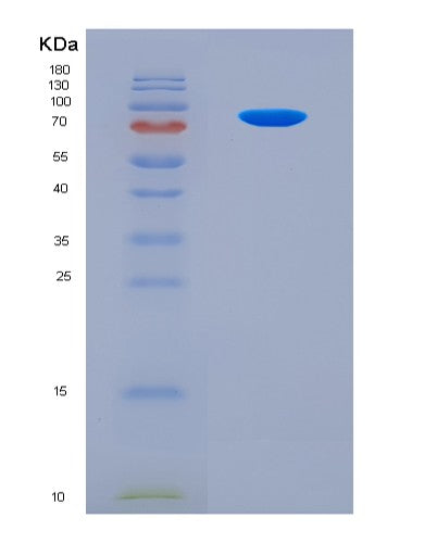 SDS-PAGE analysis of Human CRY1 (Cryptochrome-1) - Recombinant Protein, CAT# BLT-08683P showing >90% purity under 15% SDS-PAGE (Reduced)