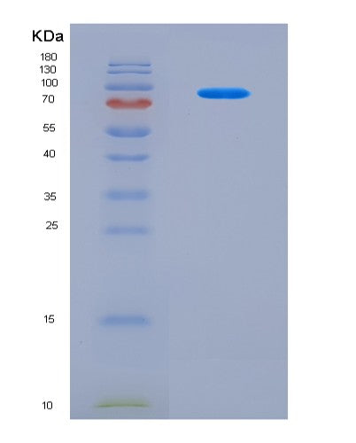 SDS-PAGE analysis of Human METTL3 (N(6)-Adenosine-Methyltransferase Catalytic Subunit Mettl3) - Recombinant Protein, CAT# BLT-08684P showing >90% purity under 15% SDS-PAGE (Reduced)