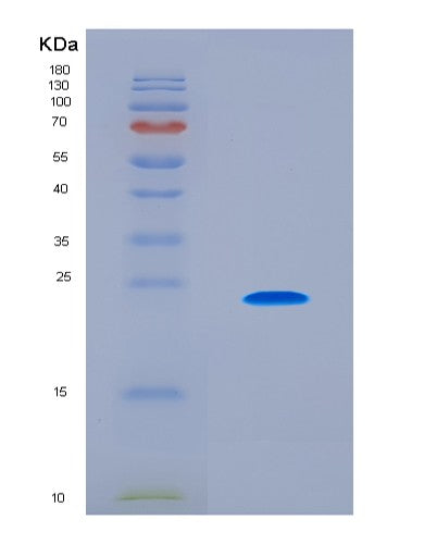 SDS-PAGE analysis of Human CLEC4C (C-Type Lectin Domain Family 4 Member C) - Recombinant Protein, CAT# BLT-08685P showing >90% purity under 15% SDS-PAGE (Reduced)