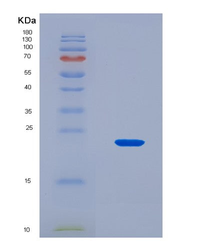 SDS-PAGE analysis of Mouse Bax (Apoptosis Regulator Bax) - Recombinant Protein, CAT# BLT-08687P showing >90% purity under 15% SDS-PAGE (Reduced)