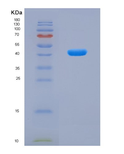 SDS-PAGE analysis of Human TCF7L2 (Transcription Factor 7-Like 2) - Recombinant Protein, CAT# BLT-08689P showing >90% purity under 15% SDS-PAGE (Reduced)