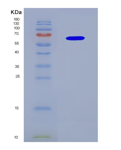 SDS-PAGE analysis of Human CYP19A1 (Aromatase) - Recombinant Protein, CAT# BLT-08691P showing >90% purity under 15% SDS-PAGE (Reduced)