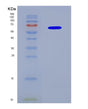 SDS-PAGE analysis of Human CYP19A1 (Aromatase) - Recombinant Protein, CAT# BLT-08691P showing >90% purity under 15% SDS-PAGE (Reduced)