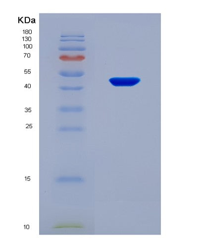 SDS-PAGE analysis of Human PNPLA3 (1-Acylglycerol-3-Phosphate O-Acyltransferase Pnpla3) - Recombinant Protein, CAT# BLT-08694P showing >90% purity under 15% SDS-PAGE (Reduced)