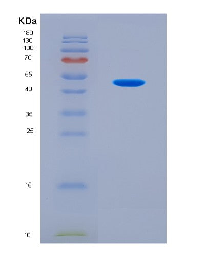 SDS-PAGE analysis of Human PNPLA3 (1-Acylglycerol-3-Phosphate O-Acyltransferase Pnpla3) - Recombinant Protein, CAT# BLT-08695P showing >90% purity under 15% SDS-PAGE (Reduced)