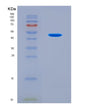 SDS-PAGE analysis of Human PNPLA3 (1-Acylglycerol-3-Phosphate O-Acyltransferase Pnpla3) - Recombinant Protein, CAT# BLT-08695P showing >90% purity under 15% SDS-PAGE (Reduced)