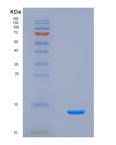 SDS-PAGE analysis of Human SPINK2 (Serine Protease Inhibitor Kazal-Type 2) - Recombinant Protein, CAT# BLT-08698P showing >90% purity under 15% SDS-PAGE (Reduced)