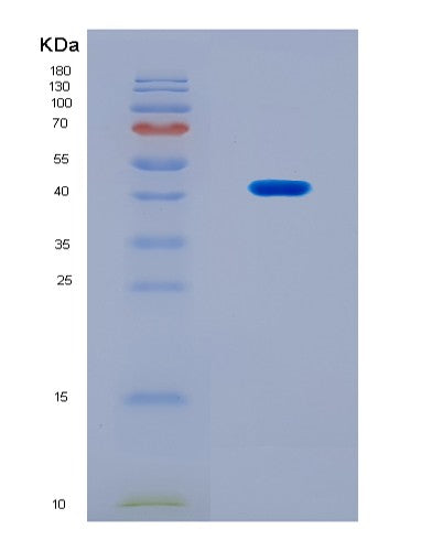 SDS-PAGE analysis of Human NR4A2 (Nuclear Receptor Subfamily 4 Group A Member 2) - Recombinant Protein, CAT# BLT-08699P showing >90% purity under 15% SDS-PAGE (Reduced)